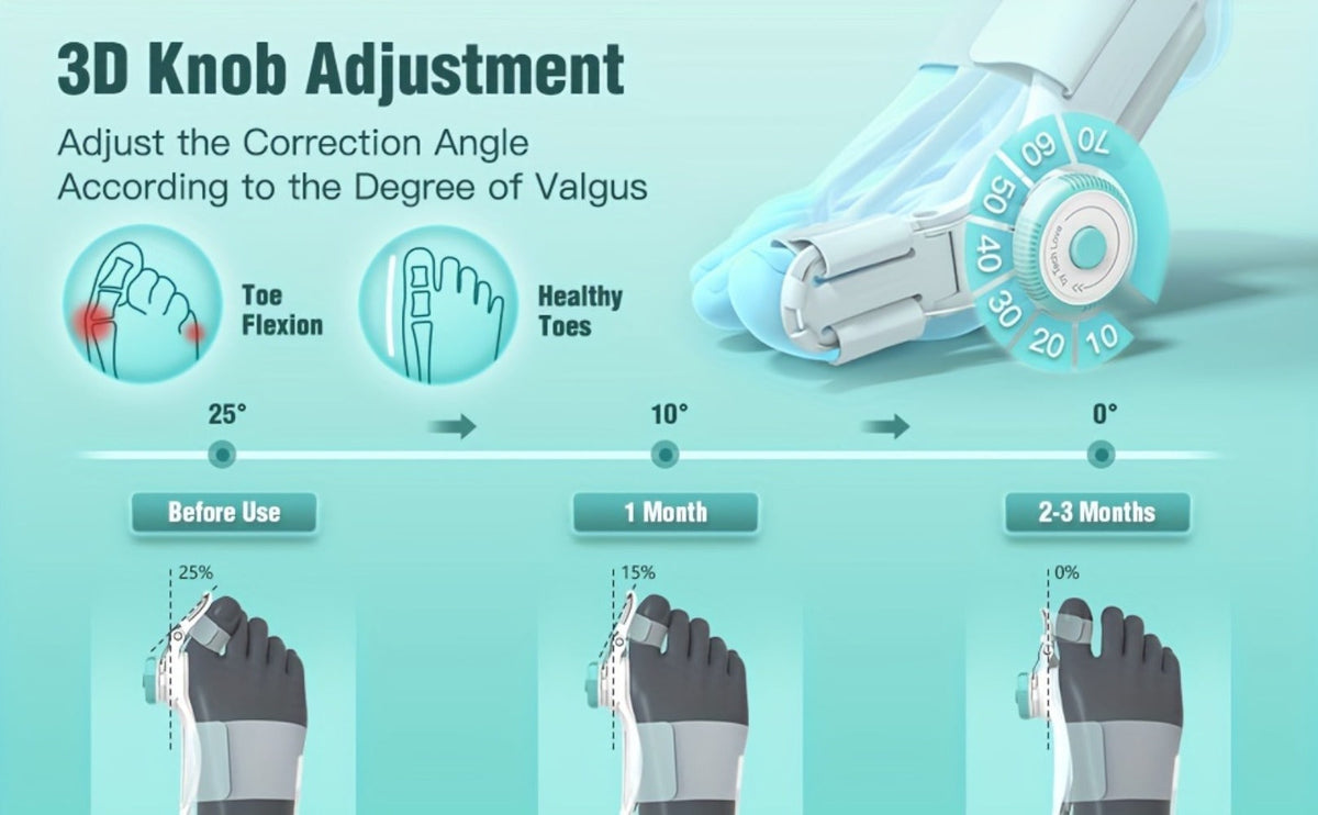 Bunion Corrector Big Toe Night Splint, Adjustable Hallux Valgus Brace with Knob & Heel Strap for Left & Right Foot, Toe Straightener for Men & Women – Relieves Bunion Pain & Corrects Toe Alignment (1pc)