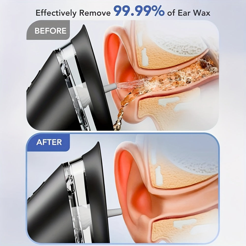 Ear Wax Removal Kit with Temp Sensor and Medical-Grade Safe Home Ear Care System