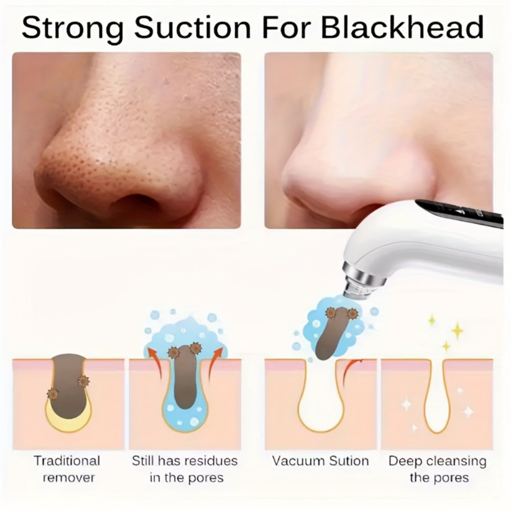 Pore Vacuum with USB Rechargeable Electric Pore Cleaner for Men and Women